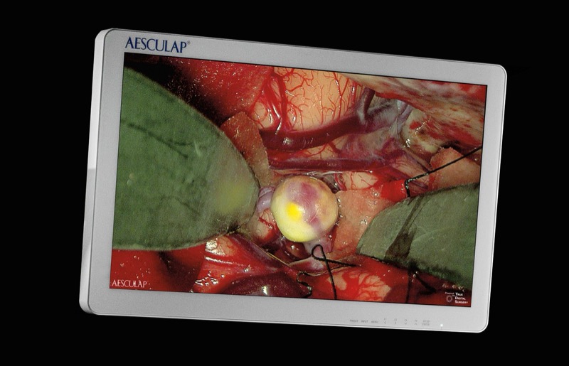 Aesculap Aeos Device
